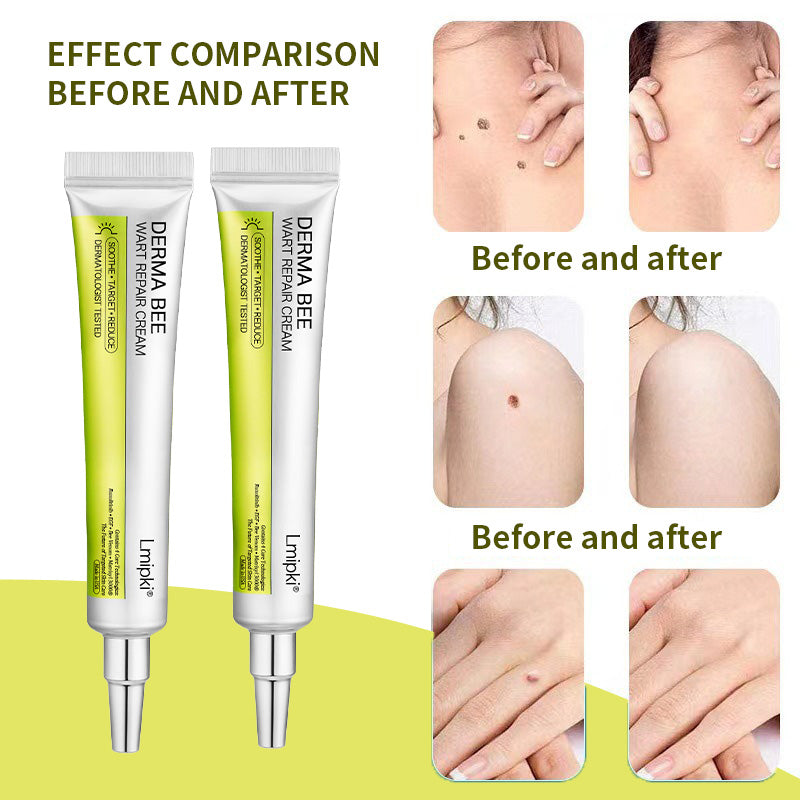 【 𝐿𝑚𝑖𝑝𝑘𝑖®Official Store】𝙇𝙢𝑖𝑝𝙠𝙞® Derma  Repair Cream👩🏼‍⚕️(𝗔𝗽𝗽𝗹𝘆 𝘁𝘄𝗶𝗰𝗲 𝗱𝗮𝗶𝗹𝘆, 𝘄𝗮𝗿𝘁-𝗳𝗿𝗲𝗲 𝗿𝗲𝘀𝘂𝗹𝘁𝘀 𝗶𝗻 𝟮–𝟯 𝘄𝗲𝗲𝗸𝘀) ✅ 𝐅𝐨𝐫 𝒔𝒌𝒊𝒏 𝒕𝒂𝒈, 𝒘𝒓𝒊𝒏𝒌𝒍𝒆𝒔, 𝒗𝒊𝒕𝒊𝒍𝒊𝒈𝒐, 𝒓𝒐𝒔𝒂𝒄𝒆𝒔, 𝒆𝒄𝒛𝒎𝒂, 𝒖𝒓𝒕𝒊𝒄𝒂𝒓𝒊𝒂, 𝒅𝒓𝒚 𝒂𝒏𝒅 𝒇𝒍𝒂𝒌𝒚, 𝐚𝐧𝐝 𝐦𝐨𝐫𝐞