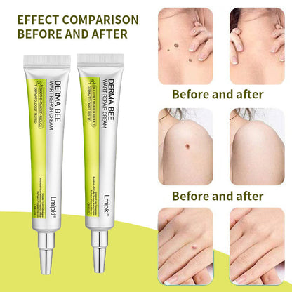 【 𝐿𝑚𝑖𝑝𝑘𝑖®Official Store】𝙇𝙢𝑖𝑝𝙠𝙞® Derma  Repair Cream👩🏼‍⚕️(𝗔𝗽𝗽𝗹𝘆 𝘁𝘄𝗶𝗰𝗲 𝗱𝗮𝗶𝗹𝘆, 𝘄𝗮𝗿𝘁-𝗳𝗿𝗲𝗲 𝗿𝗲𝘀𝘂𝗹𝘁𝘀 𝗶𝗻 𝟮–𝟯 𝘄𝗲𝗲𝗸𝘀) ✅ 𝐅𝐨𝐫 𝒔𝒌𝒊𝒏 𝒕𝒂𝒈, 𝒘𝒓𝒊𝒏𝒌𝒍𝒆𝒔, 𝒗𝒊𝒕𝒊𝒍𝒊𝒈𝒐, 𝒓𝒐𝒔𝒂𝒄𝒆𝒔, 𝒆𝒄𝒛𝒎𝒂, 𝒖𝒓𝒕𝒊𝒄𝒂𝒓𝒊𝒂, 𝒅𝒓𝒚 𝒂𝒏𝒅 𝒇𝒍𝒂𝒌𝒚, 𝐚𝐧𝐝 𝐦𝐨𝐫𝐞