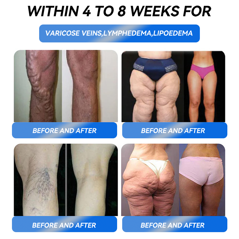 𝑶𝒇𝒇𝒊𝒄𝒊𝒂𝒍 𝑺𝒕𝒐𝒓𝒆 ✅ 𝑻𝒉𝒐𝒏𝒆𝒔𝒓® 𝑮𝒍𝒑-1 𝑷𝒓𝒐 𝑺𝒊𝒙-𝒊𝒏-𝒐𝒏𝒆 𝑺𝒍𝒊𝒎𝒎𝒊𝒏𝒈 & 𝑯𝒆𝒂𝒍𝒕𝒉 𝑾𝒆𝒊𝒈𝒉𝒕 𝑳𝒐𝒔𝒔 𝑶𝒓𝒂𝒍 𝑺𝒐𝒍𝒖𝒕𝒊𝒐𝒏  (𝐉𝐮𝐬𝐭 𝐨𝐧𝐜𝐞 𝐚 𝐝𝐚𝐲, 𝐯𝐢𝐬𝐢𝐛𝐥𝐞 𝐜𝐡𝐚𝐧𝐠𝐞𝐬 𝐢𝐧 𝟕 𝐝𝐚𝐲𝐬） ✅ 𝐅𝐨𝐫 𝐨𝐛𝐞𝐬𝐢𝐭𝐲, 𝐜𝐚𝐫𝐝𝐢𝐨𝐯𝐚𝐬𝐜𝐮𝐥𝐚𝐫 𝐡𝐞𝐚𝐥𝐭𝐡, 𝐝𝐢𝐚𝐛𝐞𝐭𝐞𝐬, 𝐬𝐥𝐞𝐞𝐩 𝐚𝐩𝐧𝐞𝐚, 𝐆𝐮𝐭 𝐇𝐞𝐚𝐥𝐭𝐡, 𝐣𝐨𝐢𝐧𝐭 𝐢𝐬𝐬𝐮𝐞𝐬, 𝐚𝐧𝐝 𝐦𝐨𝐫𝐞👍