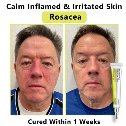 【 𝐿𝑚𝑖𝑝𝑘𝑖®Official Store】𝙇𝙢𝑖𝑝𝙠𝙞® Derma  Repair Cream👩🏼‍⚕️(𝗔𝗽𝗽𝗹𝘆 𝘁𝘄𝗶𝗰𝗲 𝗱𝗮𝗶𝗹𝘆, 𝘄𝗮𝗿𝘁-𝗳𝗿𝗲𝗲 𝗿𝗲𝘀𝘂𝗹𝘁𝘀 𝗶𝗻 𝟮–𝟯 𝘄𝗲𝗲𝗸𝘀) ✅ 𝐅𝐨𝐫 𝒔𝒌𝒊𝒏 𝒕𝒂𝒈, 𝒘𝒓𝒊𝒏𝒌𝒍𝒆𝒔, 𝒗𝒊𝒕𝒊𝒍𝒊𝒈𝒐, 𝒓𝒐𝒔𝒂𝒄𝒆𝒔, 𝒆𝒄𝒛𝒎𝒂, 𝒖𝒓𝒕𝒊𝒄𝒂𝒓𝒊𝒂, 𝒅𝒓𝒚 𝒂𝒏𝒅 𝒇𝒍𝒂𝒌𝒚, 𝐚𝐧𝐝 𝐦𝐨𝐫𝐞