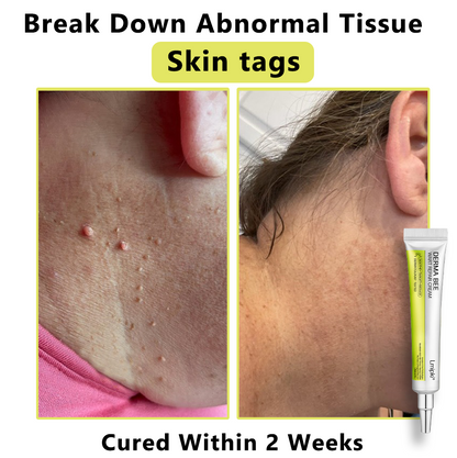 【 𝐿𝑚𝑖𝑝𝑘𝑖®Official Store】𝙇𝙢𝑖𝑝𝙠𝙞® Derma  Repair Cream👩🏼‍⚕️(𝗔𝗽𝗽𝗹𝘆 𝘁𝘄𝗶𝗰𝗲 𝗱𝗮𝗶𝗹𝘆, 𝘄𝗮𝗿𝘁-𝗳𝗿𝗲𝗲 𝗿𝗲𝘀𝘂𝗹𝘁𝘀 𝗶𝗻 𝟮–𝟯 𝘄𝗲𝗲𝗸𝘀) ✅ 𝐅𝐨𝐫 𝒔𝒌𝒊𝒏 𝒕𝒂𝒈, 𝒘𝒓𝒊𝒏𝒌𝒍𝒆𝒔, 𝒗𝒊𝒕𝒊𝒍𝒊𝒈𝒐, 𝒓𝒐𝒔𝒂𝒄𝒆𝒔, 𝒆𝒄𝒛𝒎𝒂, 𝒖𝒓𝒕𝒊𝒄𝒂𝒓𝒊𝒂, 𝒅𝒓𝒚 𝒂𝒏𝒅 𝒇𝒍𝒂𝒌𝒚, 𝐚𝐧𝐝 𝐦𝐨𝐫𝐞