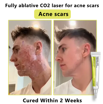 【 𝐿𝑚𝑖𝑝𝑘𝑖®Official Store】𝙇𝙢𝑖𝑝𝙠𝙞® Derma  Repair Cream👩🏼‍⚕️(𝗔𝗽𝗽𝗹𝘆 𝘁𝘄𝗶𝗰𝗲 𝗱𝗮𝗶𝗹𝘆, 𝘄𝗮𝗿𝘁-𝗳𝗿𝗲𝗲 𝗿𝗲𝘀𝘂𝗹𝘁𝘀 𝗶𝗻 𝟮–𝟯 𝘄𝗲𝗲𝗸𝘀) ✅ 𝐅𝐨𝐫 𝒔𝒌𝒊𝒏 𝒕𝒂𝒈, 𝒘𝒓𝒊𝒏𝒌𝒍𝒆𝒔, 𝒗𝒊𝒕𝒊𝒍𝒊𝒈𝒐, 𝒓𝒐𝒔𝒂𝒄𝒆𝒔, 𝒆𝒄𝒛𝒎𝒂, 𝒖𝒓𝒕𝒊𝒄𝒂𝒓𝒊𝒂, 𝒅𝒓𝒚 𝒂𝒏𝒅 𝒇𝒍𝒂𝒌𝒚, 𝐚𝐧𝐝 𝐦𝐨𝐫𝐞