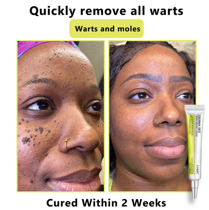 【 𝐿𝑚𝑖𝑝𝑘𝑖®Official Store】𝙇𝙢𝑖𝑝𝙠𝙞® Derma  Repair Cream👩🏼‍⚕️(𝗔𝗽𝗽𝗹𝘆 𝘁𝘄𝗶𝗰𝗲 𝗱𝗮𝗶𝗹𝘆, 𝘄𝗮𝗿𝘁-𝗳𝗿𝗲𝗲 𝗿𝗲𝘀𝘂𝗹𝘁𝘀 𝗶𝗻 𝟮–𝟯 𝘄𝗲𝗲𝗸𝘀) ✅ 𝐅𝐨𝐫 𝒔𝒌𝒊𝒏 𝒕𝒂𝒈, 𝒘𝒓𝒊𝒏𝒌𝒍𝒆𝒔, 𝒗𝒊𝒕𝒊𝒍𝒊𝒈𝒐, 𝒓𝒐𝒔𝒂𝒄𝒆𝒔, 𝒆𝒄𝒛𝒎𝒂, 𝒖𝒓𝒕𝒊𝒄𝒂𝒓𝒊𝒂, 𝒅𝒓𝒚 𝒂𝒏𝒅 𝒇𝒍𝒂𝒌𝒚, 𝐚𝐧𝐝 𝐦𝐨𝐫𝐞